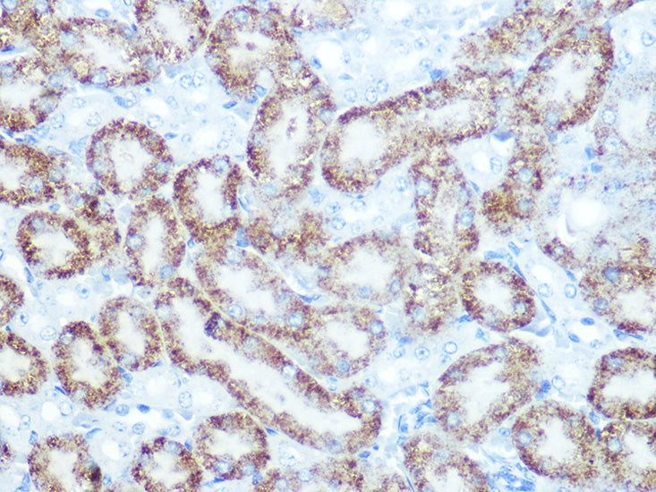 Catalase Rabbit mAb