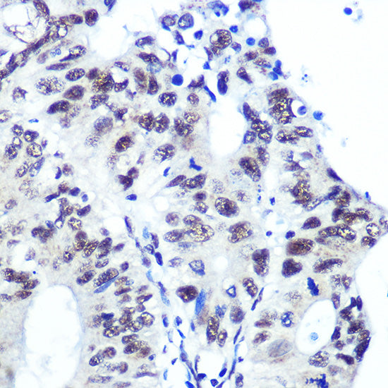 Ku70 Rabbit mAb