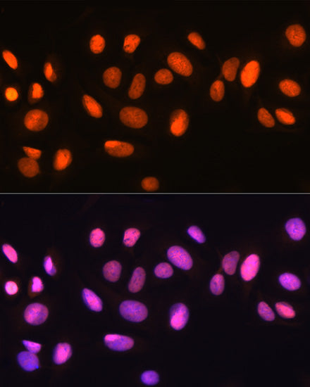 Ku70 Rabbit mAb