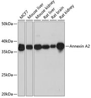 Annexin A2 Rabbit mAb
