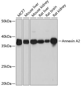 Annexin A2 Rabbit mAb