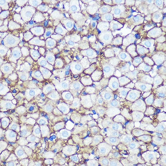 Annexin A2 Rabbit mAb