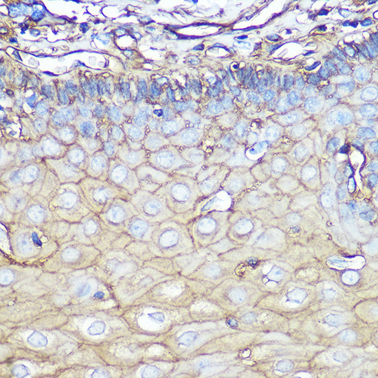 Annexin A2 Rabbit mAb