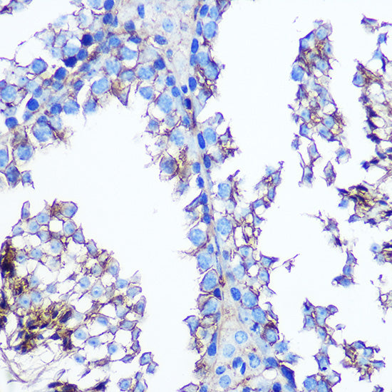 Annexin A2 Rabbit mAb