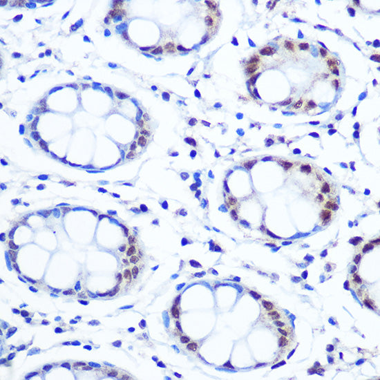 APEX1/APE1 Rabbit mAb