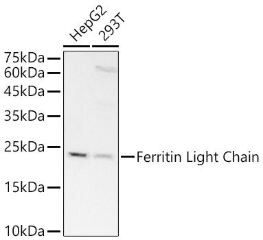 [KD Validated] Ferritin Light Chain Rabbit mAb