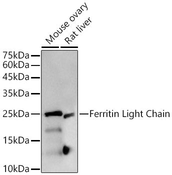 [KD Validated] Ferritin Light Chain Rabbit mAb