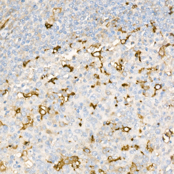 [KD Validated] Ferritin Light Chain Rabbit mAb