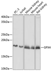[KD Validated] GPX4 Rabbit mAb