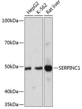 SERPINC1 Rabbit mAb