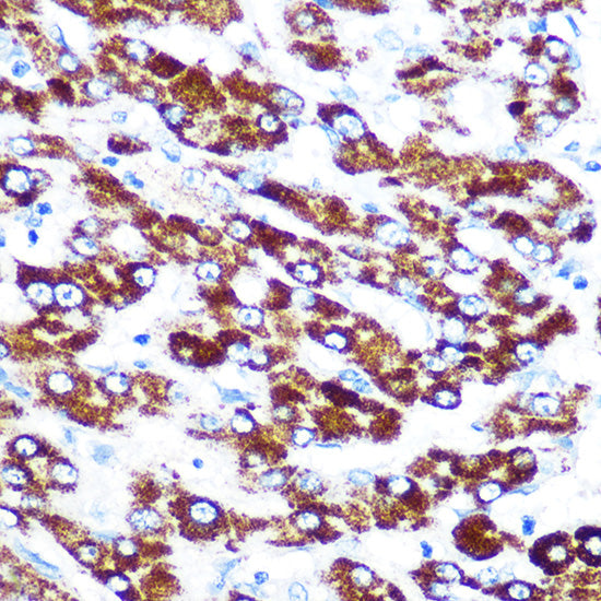 SERPINC1 Rabbit mAb