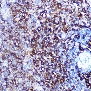 HLA-DQA1 Rabbit mAb