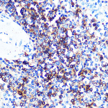 HLA-DQA1 Rabbit mAb