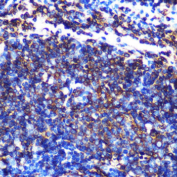 HLA-DQA1 Rabbit mAb