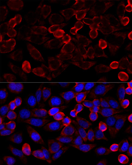 HDAC6 Rabbit pAb