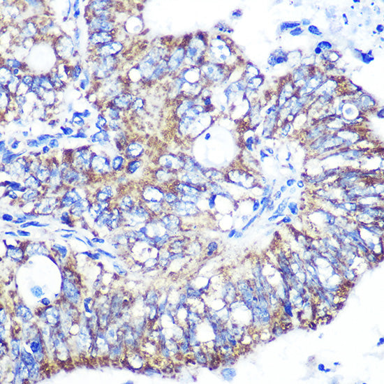 IDH2 Rabbit mAb
