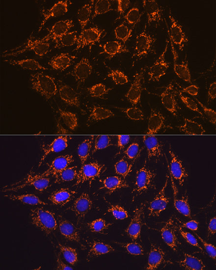 IDH2 Rabbit mAb