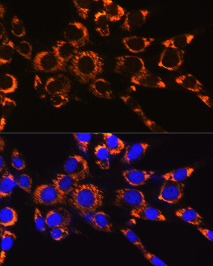 IDH2 Rabbit mAb