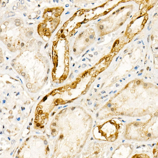 [KO Validated] NADPH oxidase 4 (NOX4) Rabbit pAb