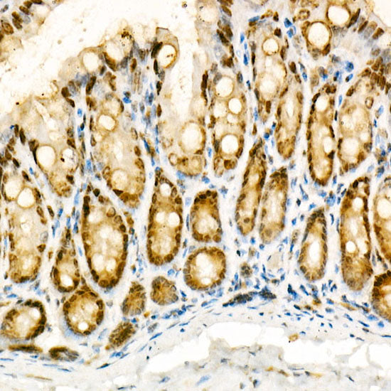 [KO Validated] NADPH oxidase 4 (NOX4) Rabbit pAb