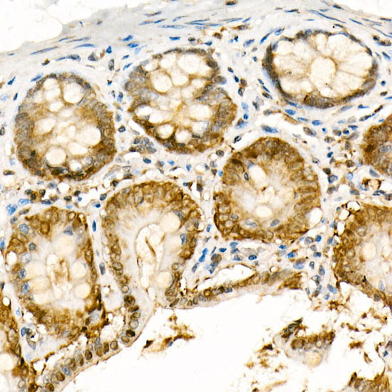 [KO Validated] NADPH oxidase 4 (NOX4) Rabbit pAb