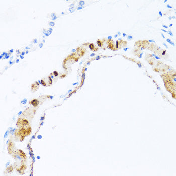 PHPT1 Rabbit pAb