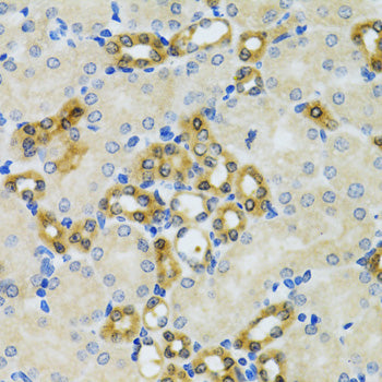 PHPT1 Rabbit pAb