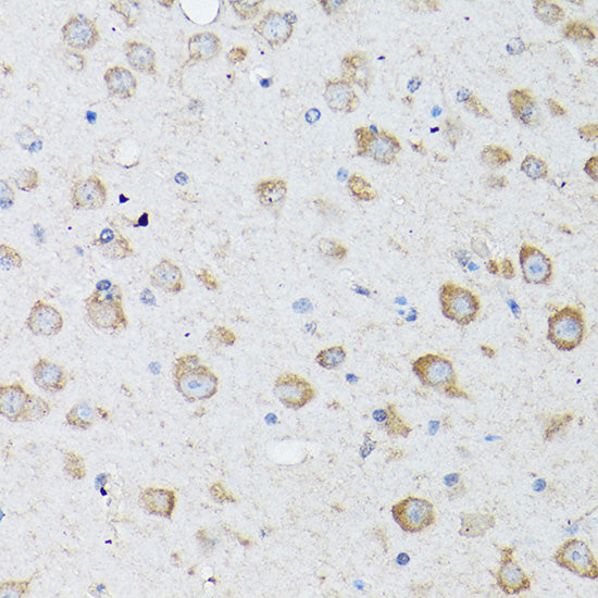 LC3B Rabbit pAb