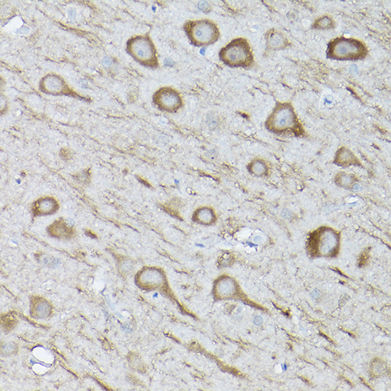 LC3B Rabbit pAb