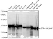 GC1q R/C1QBP Rabbit mAb
