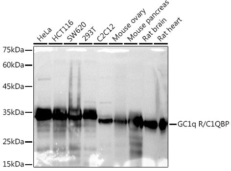 GC1q R/C1QBP Rabbit mAb