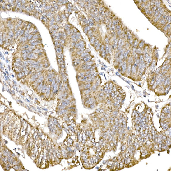 GC1q R/C1QBP Rabbit mAb