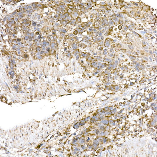 GC1q R/C1QBP Rabbit mAb
