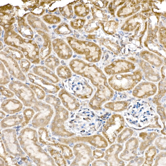 GC1q R/C1QBP Rabbit mAb