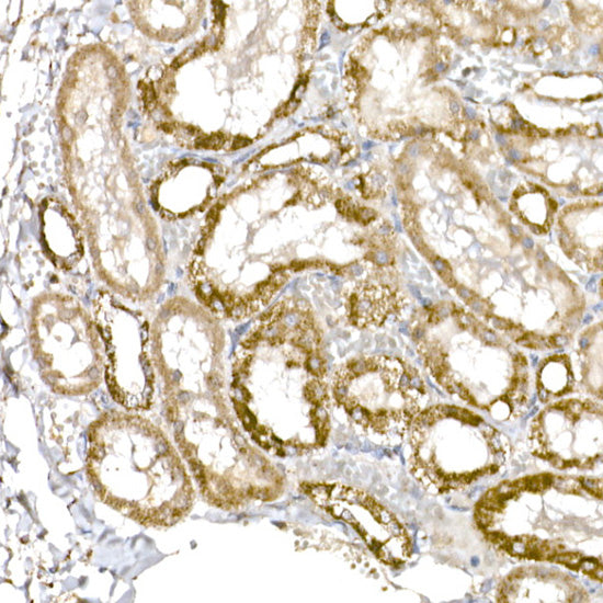 GC1q R/C1QBP Rabbit mAb