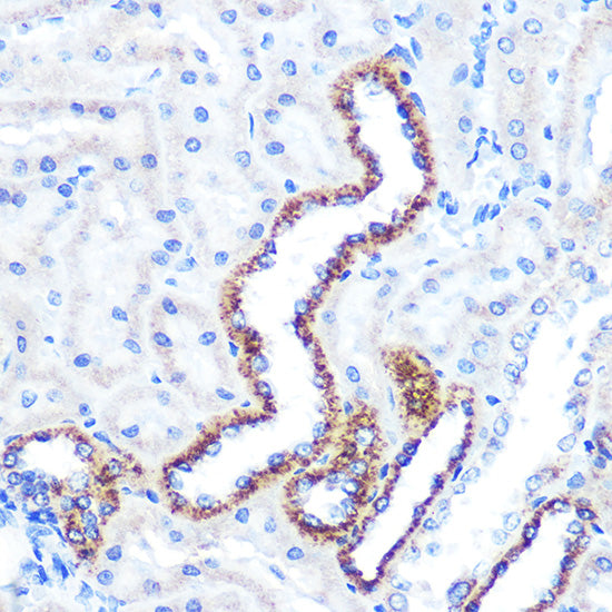 ANGPT2 Rabbit mAb