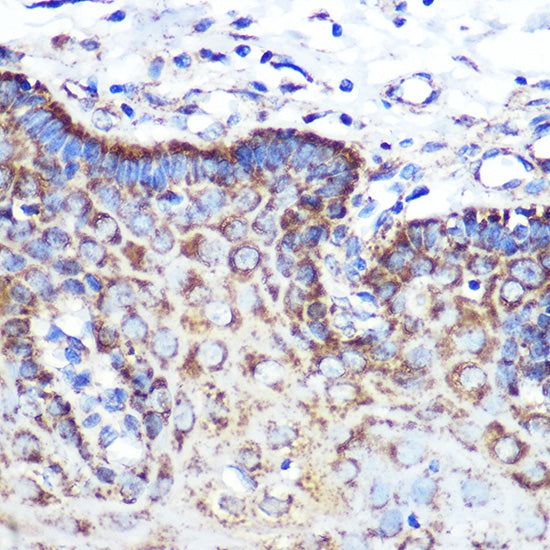 ANGPT2 Rabbit mAb