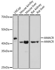 AMACR Rabbit pAb