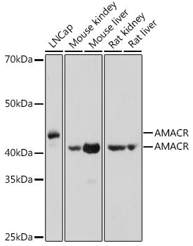 AMACR Rabbit pAb
