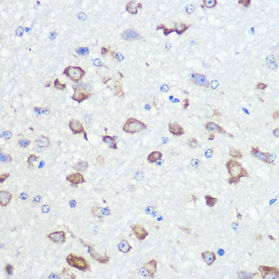 GluR2/GRIA2 Rabbit mAb