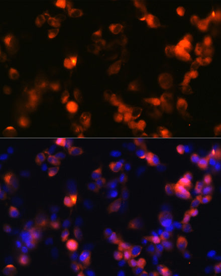 GluR2/GRIA2 Rabbit mAb