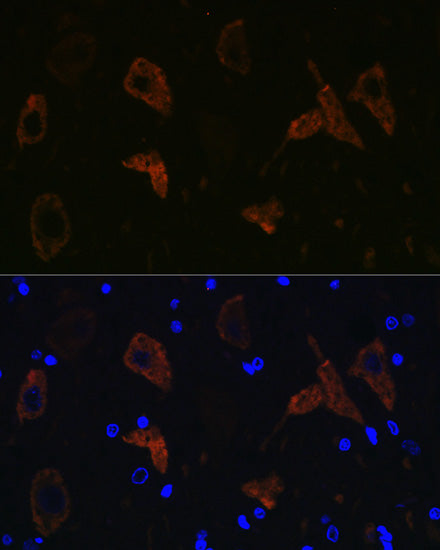 GluR2/GRIA2 Rabbit mAb