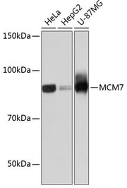 MCM7 Rabbit mAb