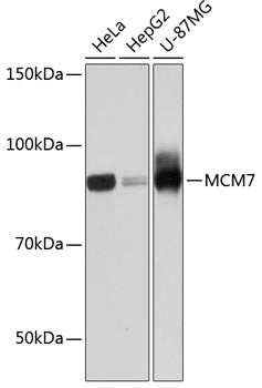 MCM7 Rabbit mAb
