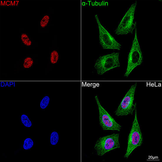 MCM7 Rabbit mAb