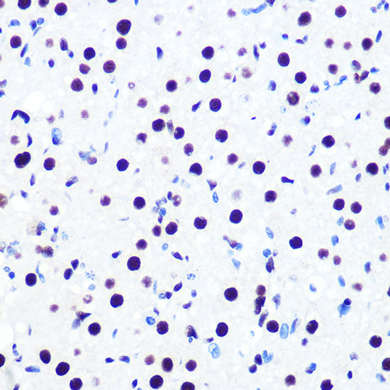 DDX5 Rabbit mAb