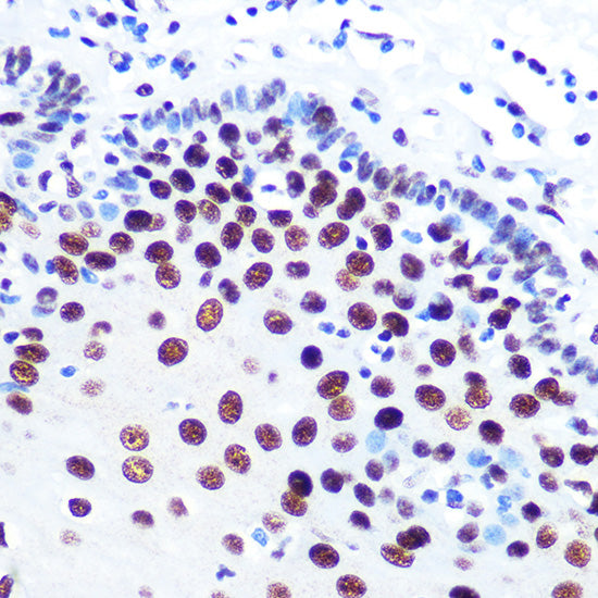 DDX5 Rabbit mAb