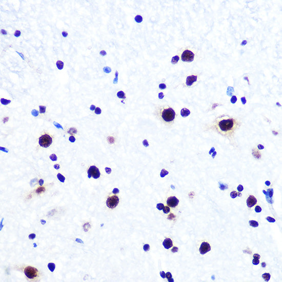 DDX5 Rabbit mAb