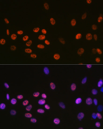 DDX5 Rabbit mAb