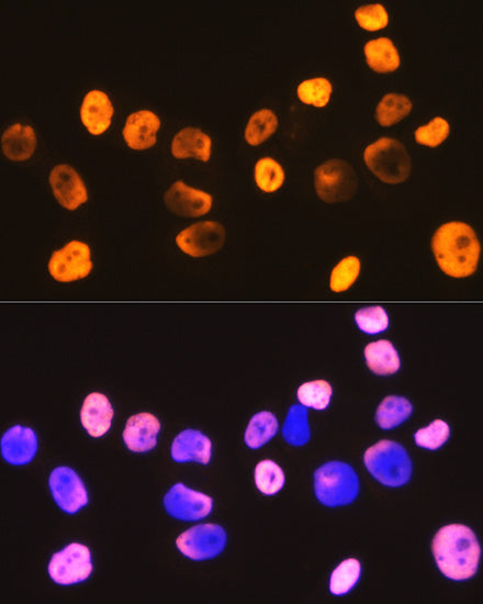 DDX5 Rabbit mAb